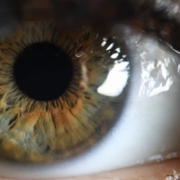 An image of an eye.